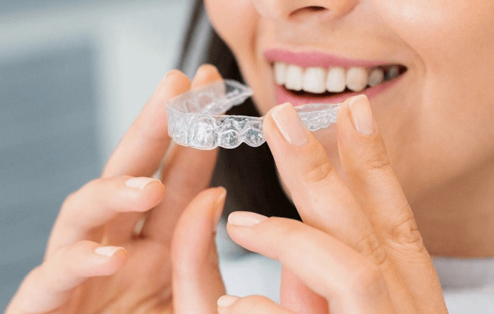 INVISALIGN-01